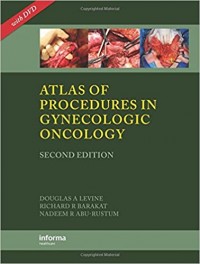 Ebook: Atlas of Procedures in Gynecologic Oncology second edition